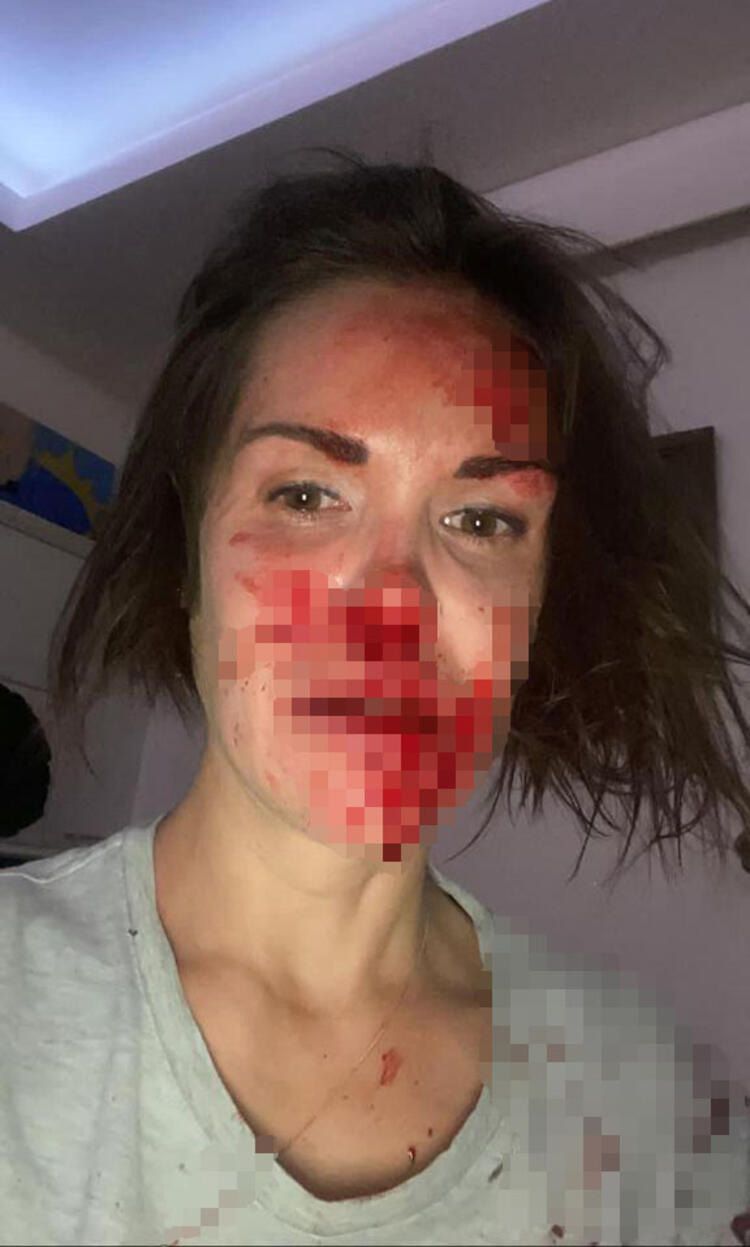 Rus Vera lüks sitede ölü bulundu! 3
