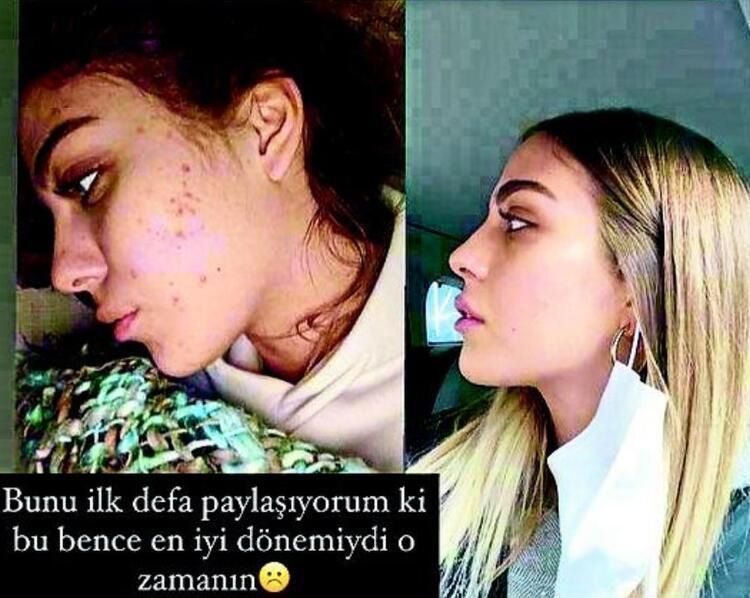 Yasemin Şefkatli takipçilerini uyardı: Bilmediğiniz ürünleri kullanmayın... 3