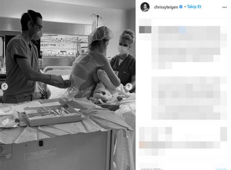 Ünlü model Chrissy Teigen hayata döndü! 7