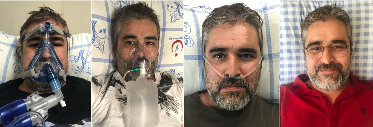 26 günlük Kovid işkencesini fotoğraflarla anlattı 2