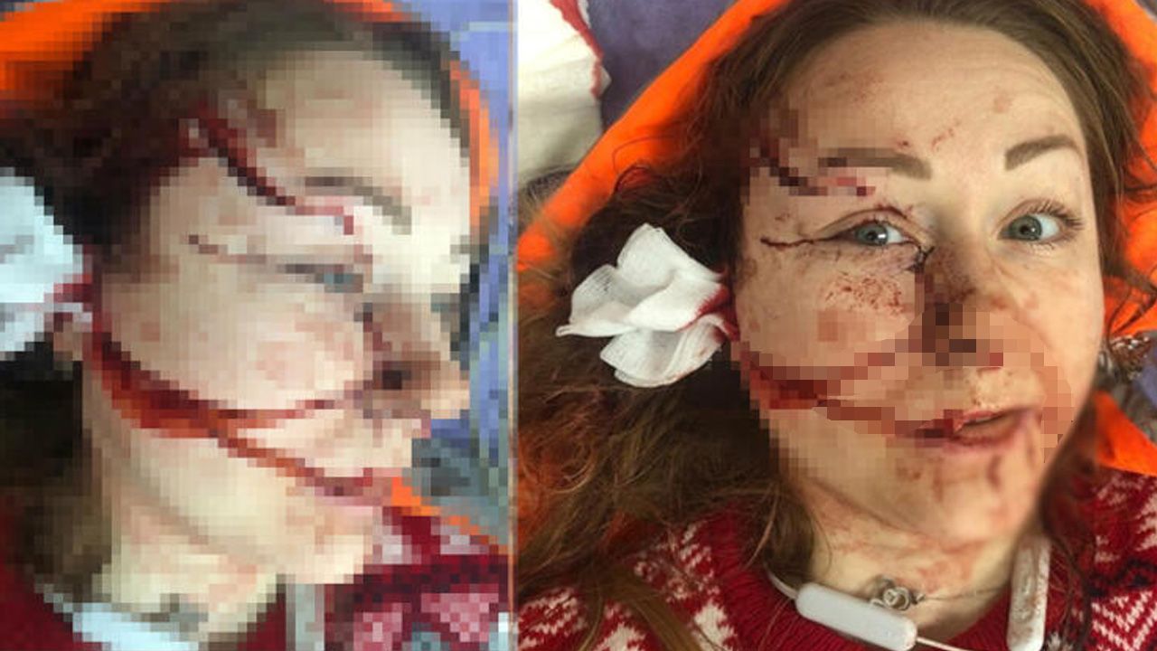 Boşanmak isteyen eşini falçatayla bu hale getirdi! Tutuklandı... 1