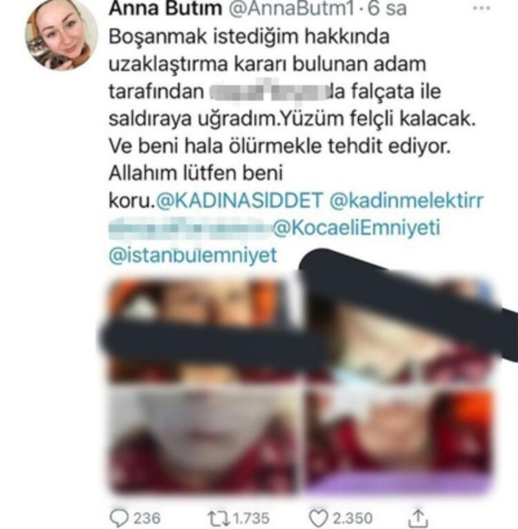 Boşanmak isteyen eşini falçatayla bu hale getirdi! Tutuklandı... 5