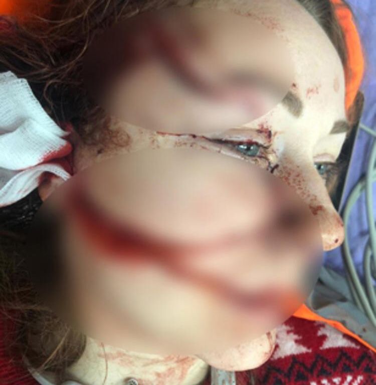 Boşanmak isteyen eşini falçatayla bu hale getirdi! Tutuklandı... 7
