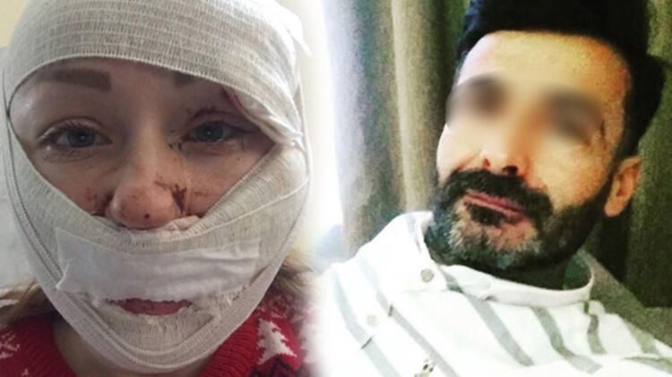 Boşanmak isteyen eşini falçatayla bu hale getirdi! Tutuklandı... 9