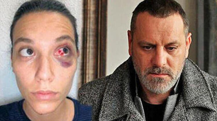 Ozan Güven-Deniz Bulutsuz davası! 7