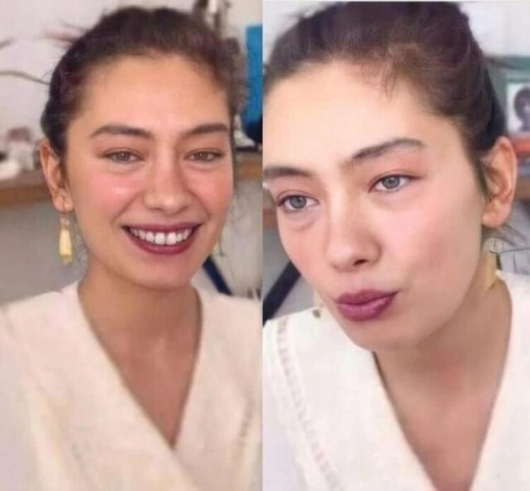 Neslihan Atagül'ün sağlık durumu! 4