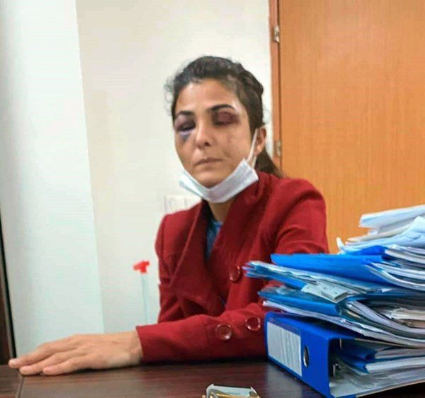 Melek İpek'i o rapor kurtaracak 10