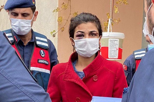 Melek İpek'i o rapor kurtaracak 13