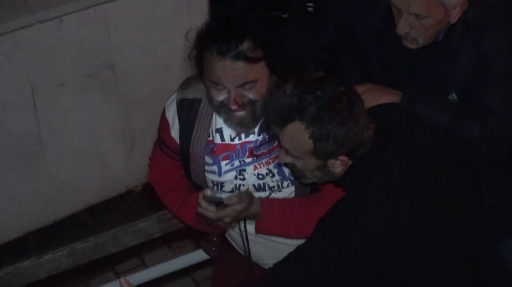 Dükkanı alev alev yanan antikacı ve oğlu darp edildi 6