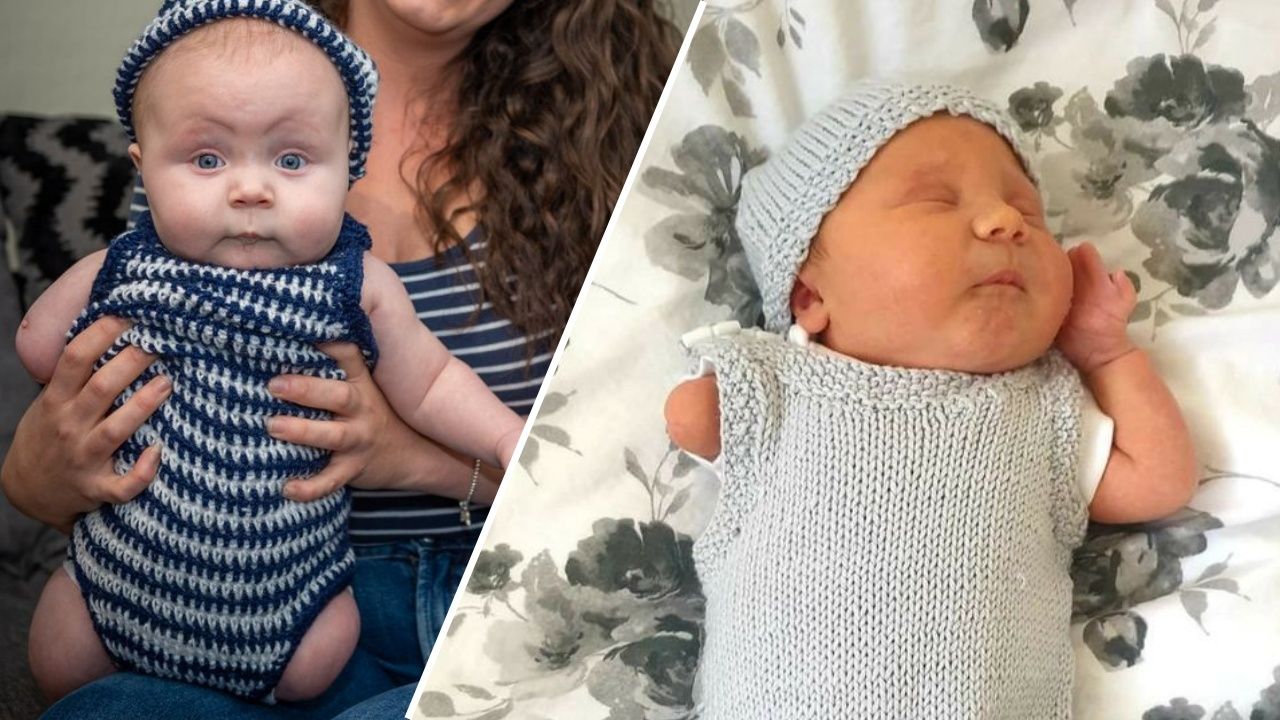 Anne karnında kordon dolandı, kolu ve bacakları olmadan dünyaya geldi! 1