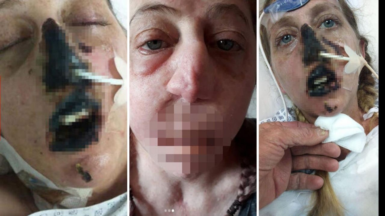 Fare ısırdı hayatı kabusa döndü! Burnu, dudakları, bacakları ve kolları kesildi... 1