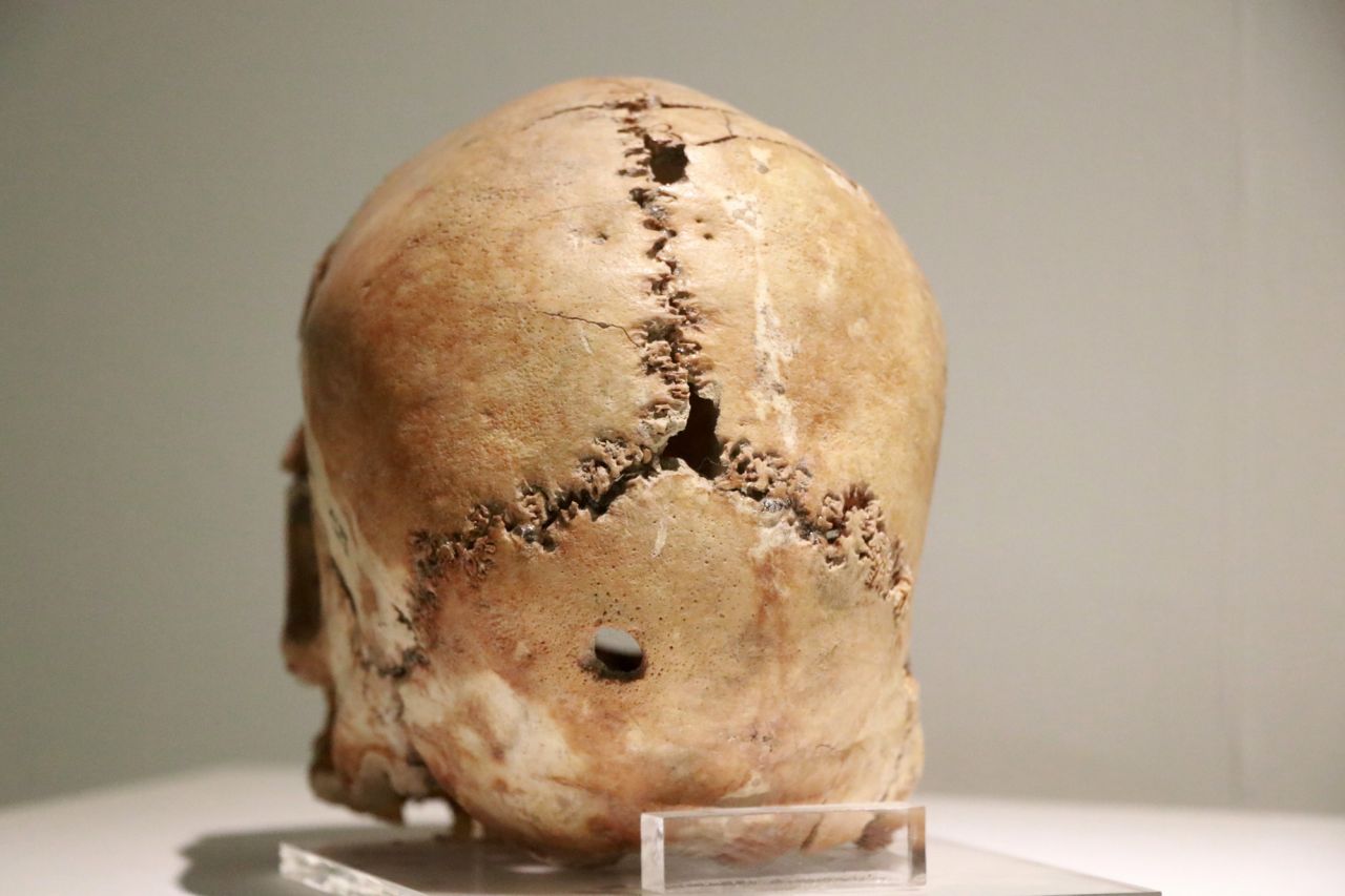 Aşıklı Höyük 11 bin yıllık tarihe ışık tutuyor 7