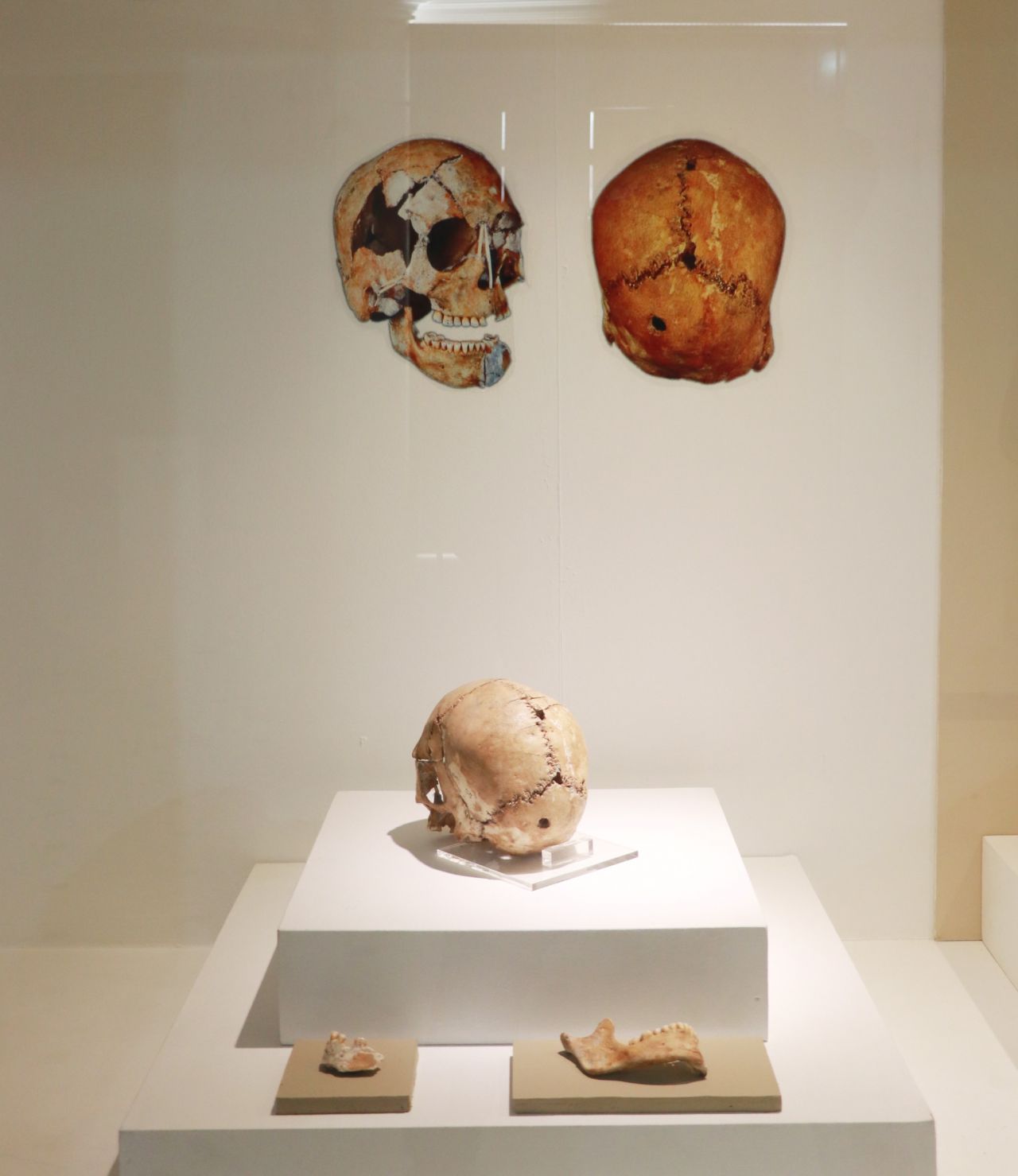 Aşıklı Höyük 11 bin yıllık tarihe ışık tutuyor 8