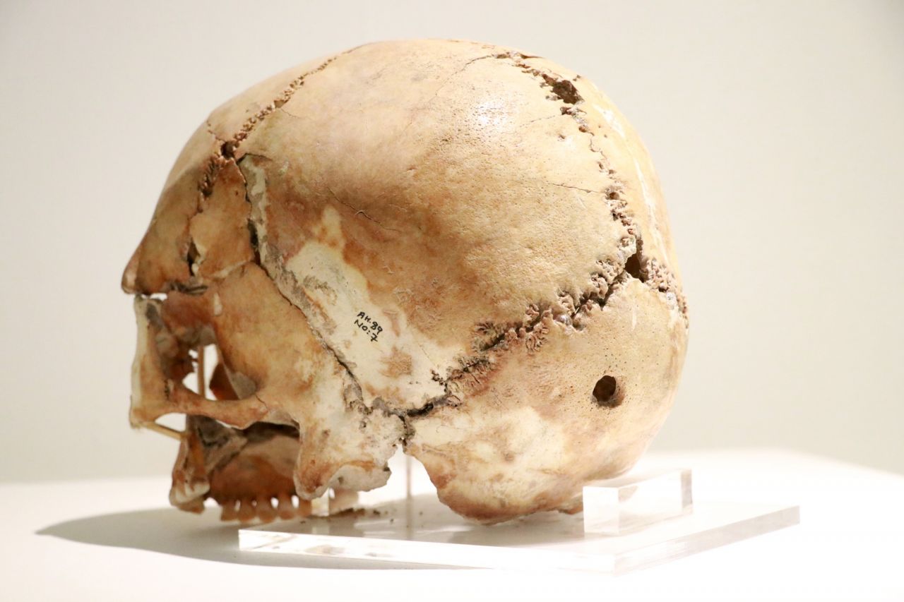 Aşıklı Höyük 11 bin yıllık tarihe ışık tutuyor 3
