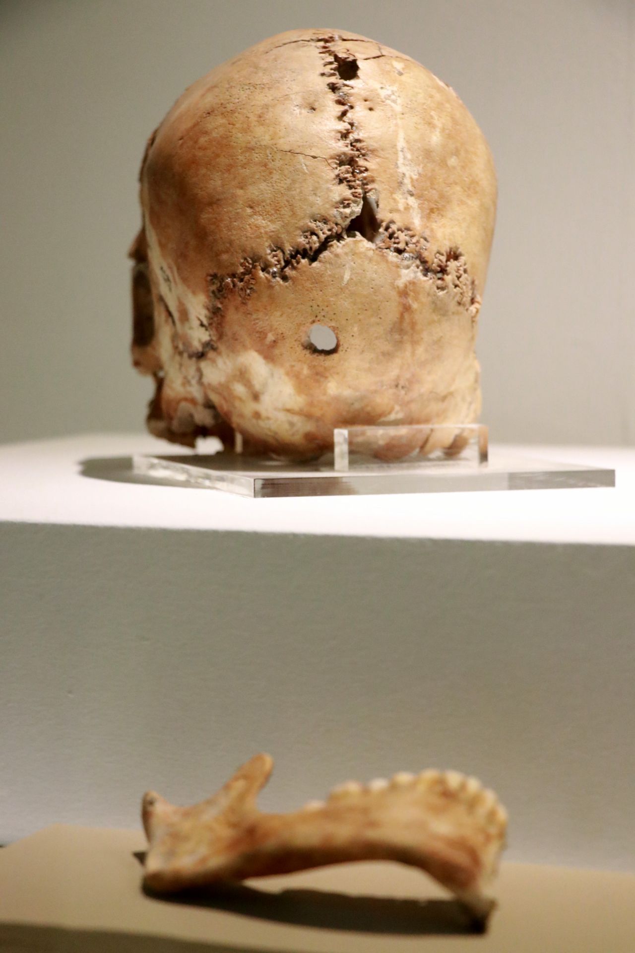 Aşıklı Höyük 11 bin yıllık tarihe ışık tutuyor 5