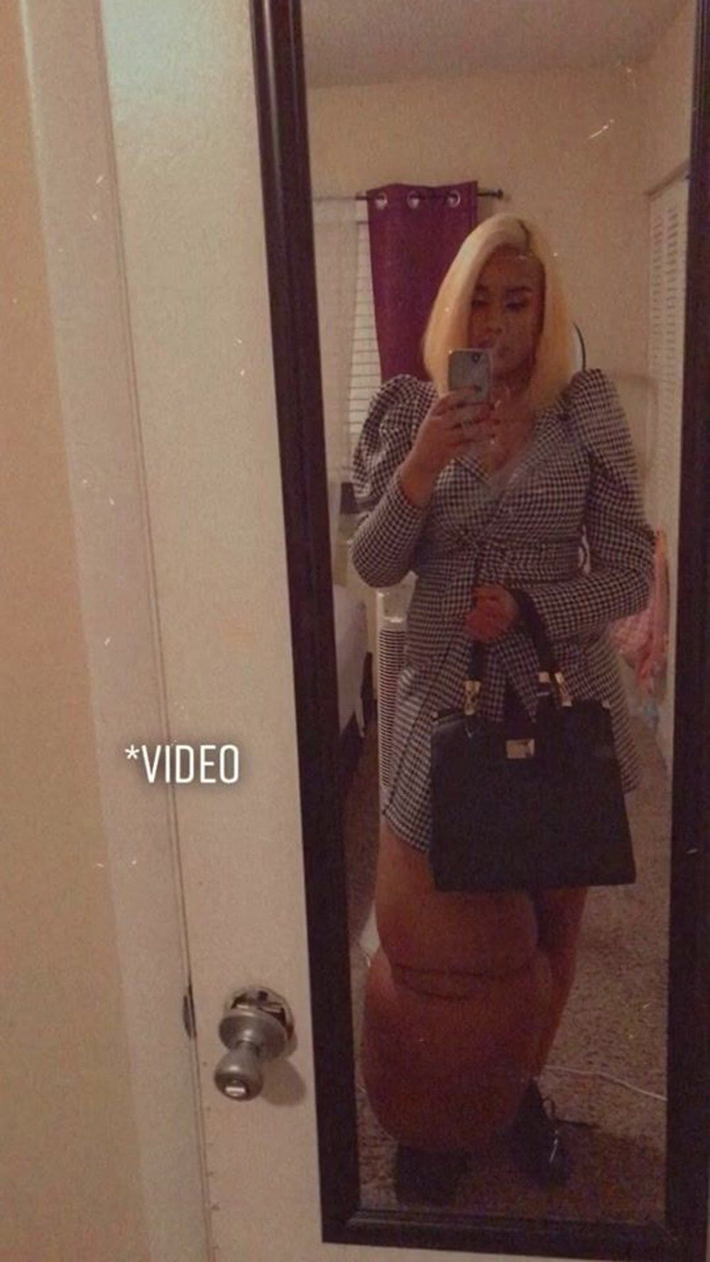 Bacaklarından biri 45 kilo! Fil hastalığı olan genç kadın kendiyle barışmayı öğrendi... 6
