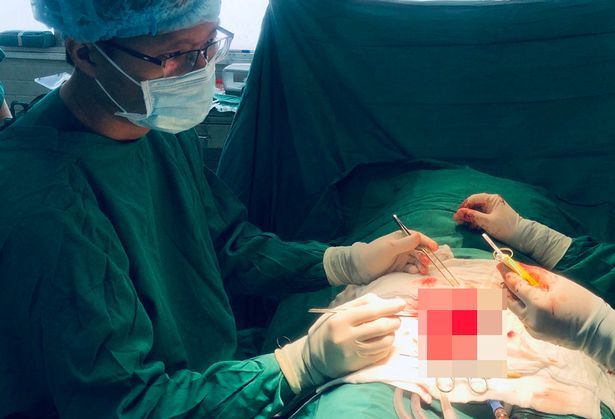 Kıskanç kadın, uyuyan kocasının cinsel organını makasla kesti! 8