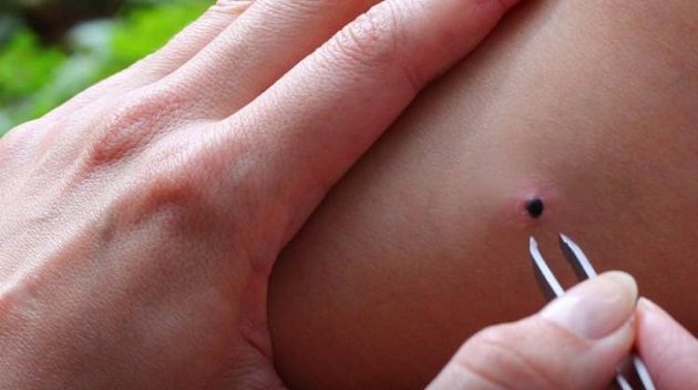 Uzman isimden korkutan uyarı: 900'e yakın hastalığı insana bulaştırıyor! 2