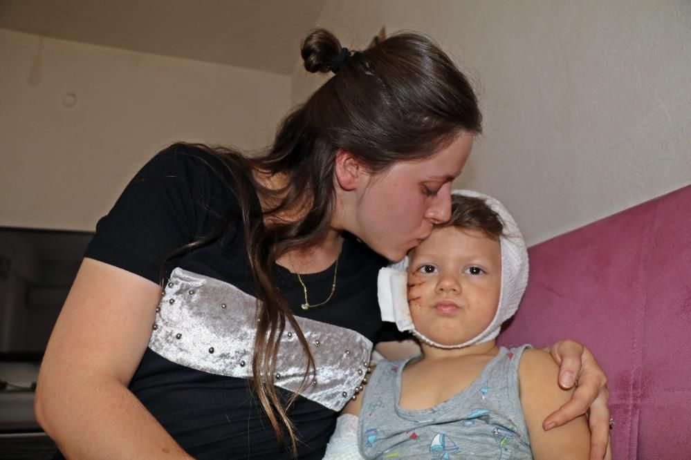 Sevmek istediği köpek 3,5 yaşındaki çocuğu bu hale getirdi: 50 dikiş atıldı... 3