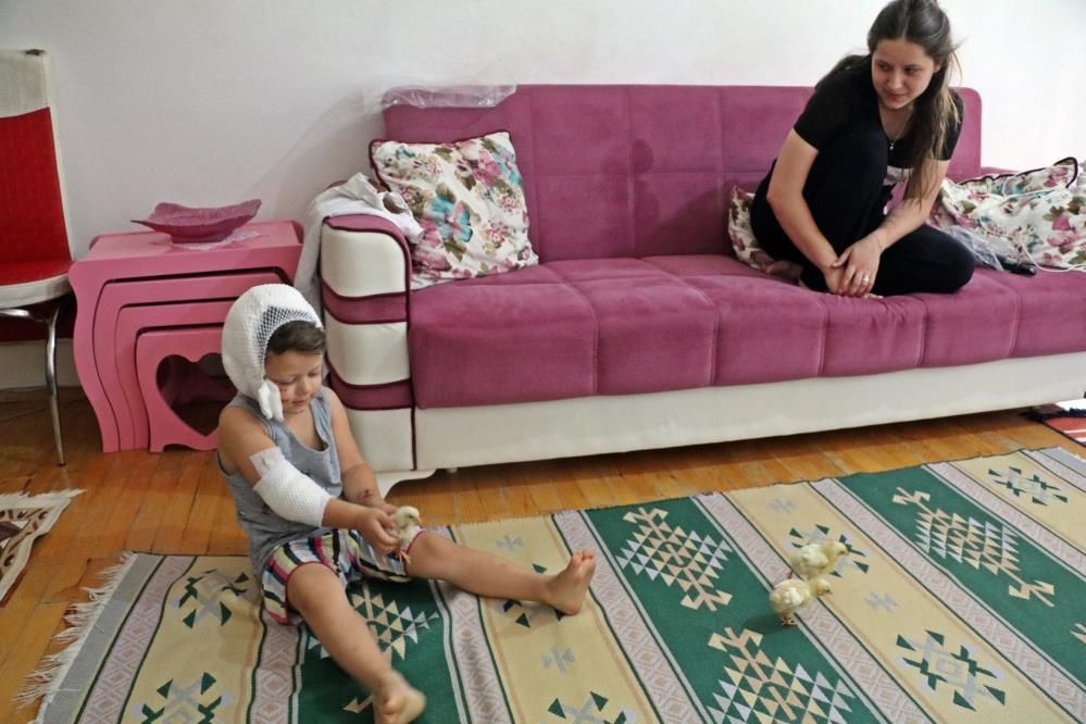 Sevmek istediği köpek 3,5 yaşındaki çocuğu bu hale getirdi: 50 dikiş atıldı... 4