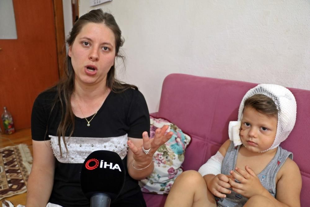 Sevmek istediği köpek 3,5 yaşındaki çocuğu bu hale getirdi: 50 dikiş atıldı... 10
