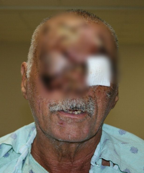 Böyle canilik görülmedi: Yamyam, evsiz adamın canlı canlı suratını yedi! 2