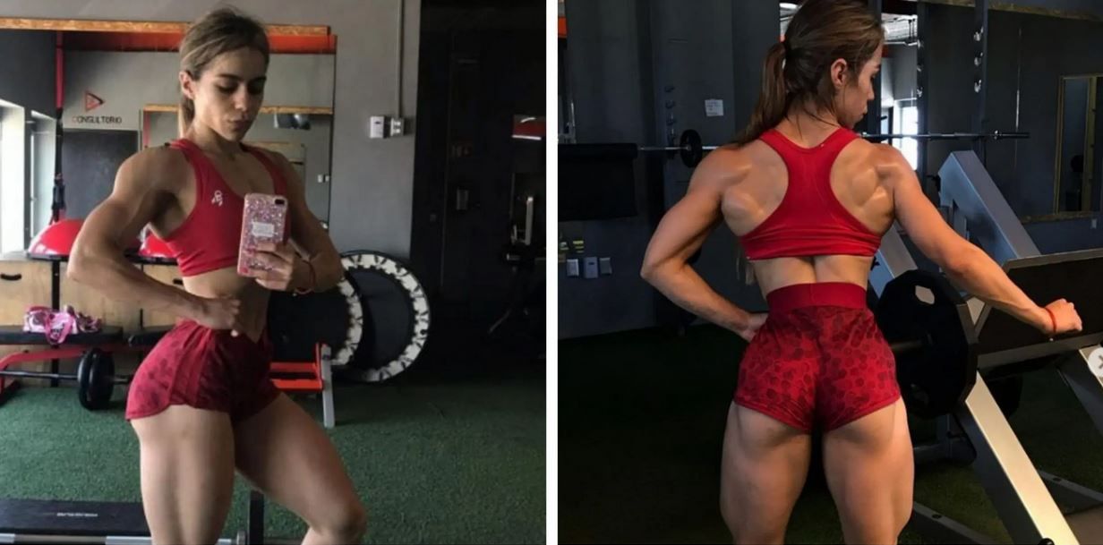 Instagram fenomeni reklamını yaptığı ameliyat sırasında hayatını kaybetti! 2