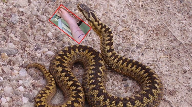 Doktorlar gözlerine inanamadı: Böylesini daha önce görmedik! 5