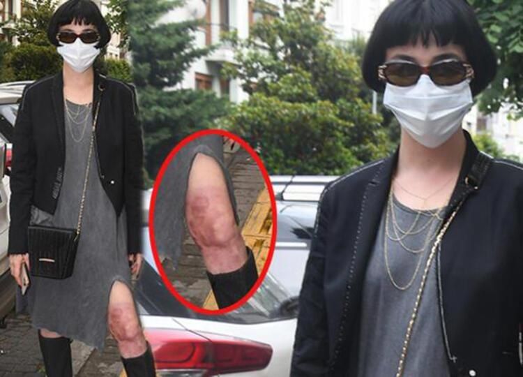 Belinden aşağı kaynar su dökülmüştü! Gonca Vuslateri son halini paylaştı! İşte yeni tarzı! 6