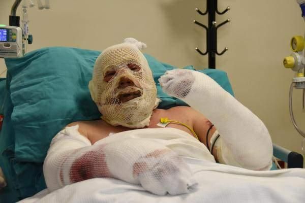 Alevlerin arasında kalan kahraman ormancı: Bir cesaret geldi koşmaya başladım! 4