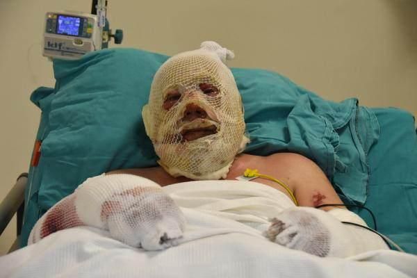 Alevlerin arasında kalan kahraman ormancı: Bir cesaret geldi koşmaya başladım! 1