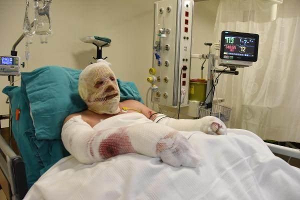 Alevlerin arasında kalan kahraman ormancı: Bir cesaret geldi koşmaya başladım! 10