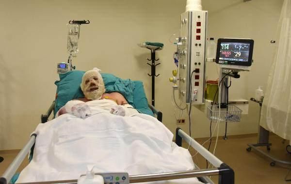 Alevlerin arasında kalan kahraman ormancı: Bir cesaret geldi koşmaya başladım! 2