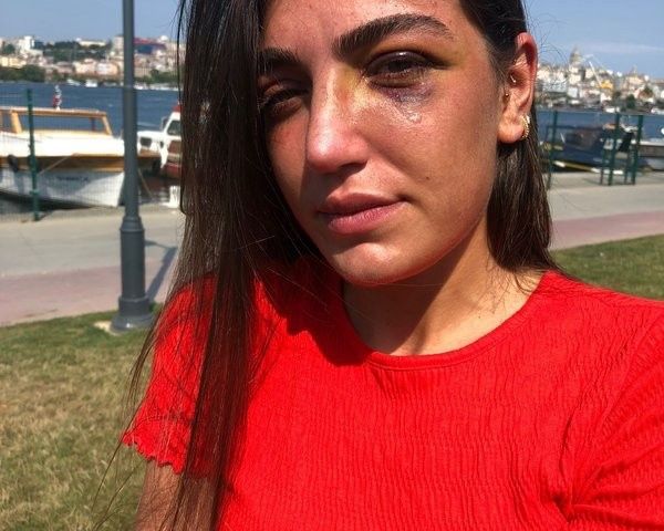 Öldüresiye dövmüştü! Manken Gizem Akbaş saplantılı eski sevgilisinin tahliyesine isyan etti 8