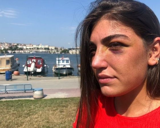 Öldüresiye dövmüştü! Manken Gizem Akbaş saplantılı eski sevgilisinin tahliyesine isyan etti 9