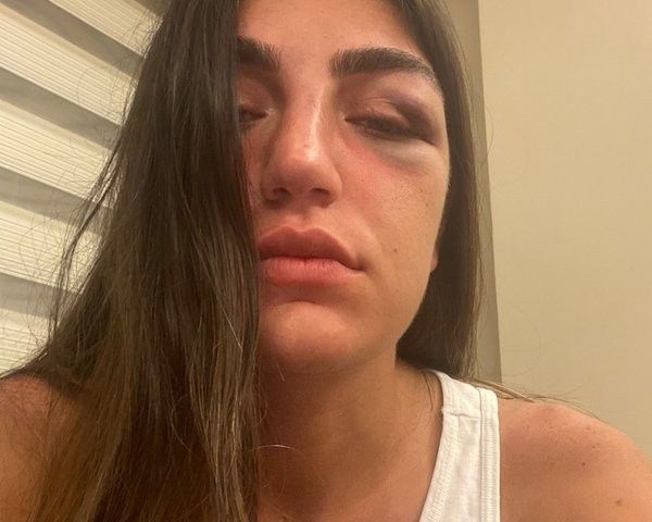 Öldüresiye dövmüştü! Manken Gizem Akbaş saplantılı eski sevgilisinin tahliyesine isyan etti 11