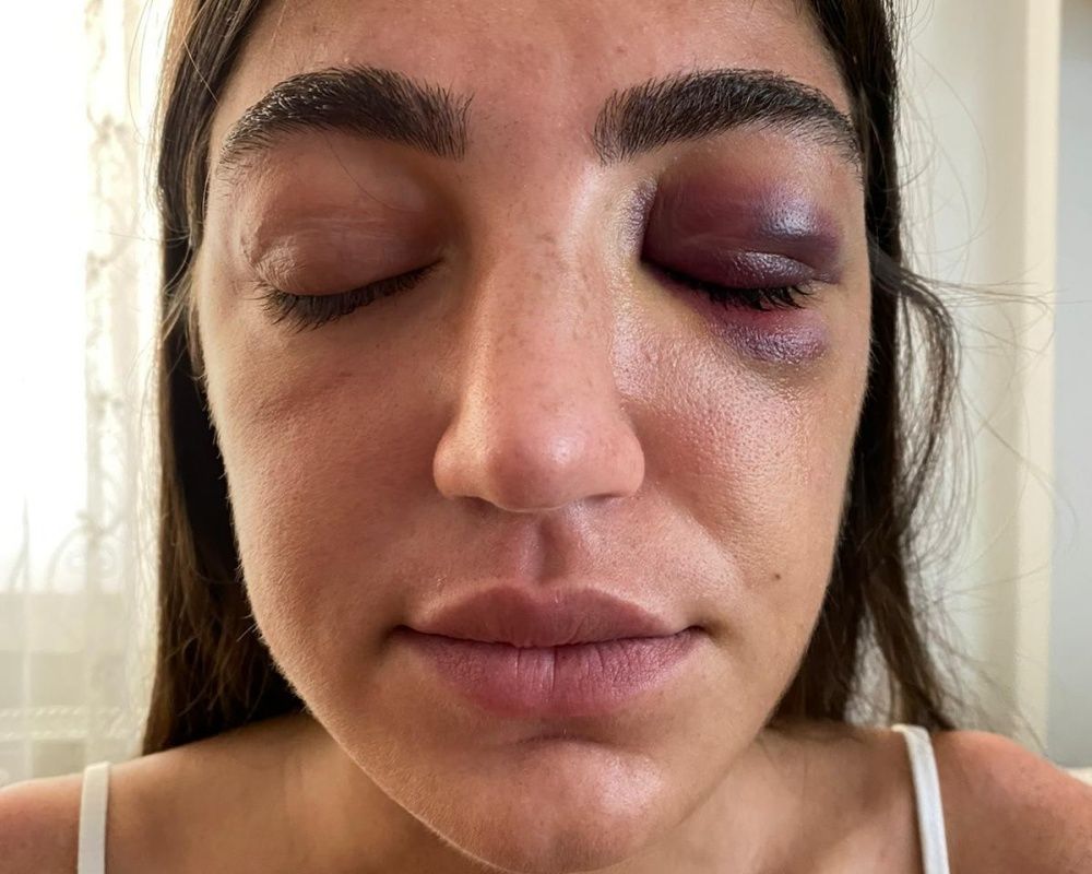 Öldüresiye dövmüştü! Manken Gizem Akbaş saplantılı eski sevgilisinin tahliyesine isyan etti 14