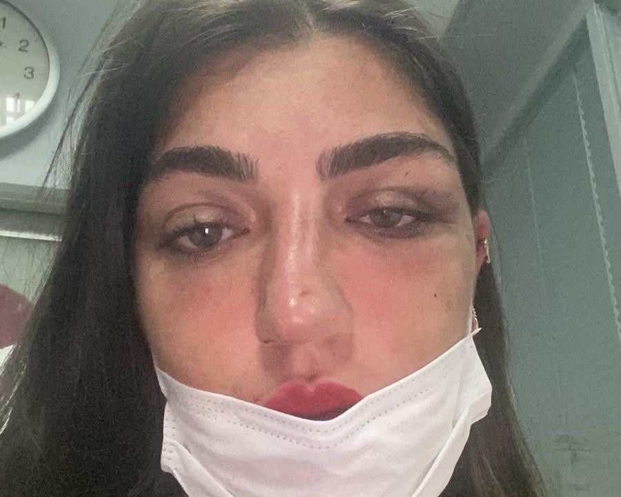 Öldüresiye dövmüştü! Manken Gizem Akbaş saplantılı eski sevgilisinin tahliyesine isyan etti 15