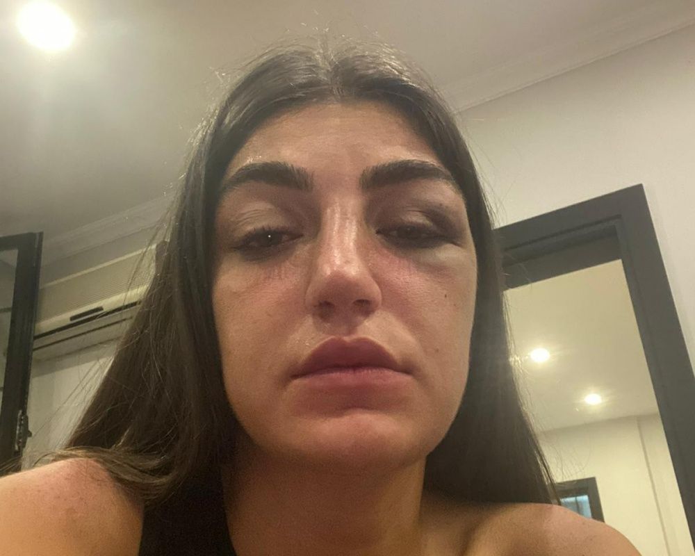 Öldüresiye dövmüştü! Manken Gizem Akbaş saplantılı eski sevgilisinin tahliyesine isyan etti 16