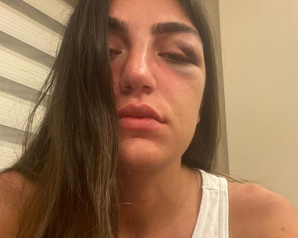 Öldüresiye dövmüştü! Manken Gizem Akbaş saplantılı eski sevgilisinin tahliyesine isyan etti 17