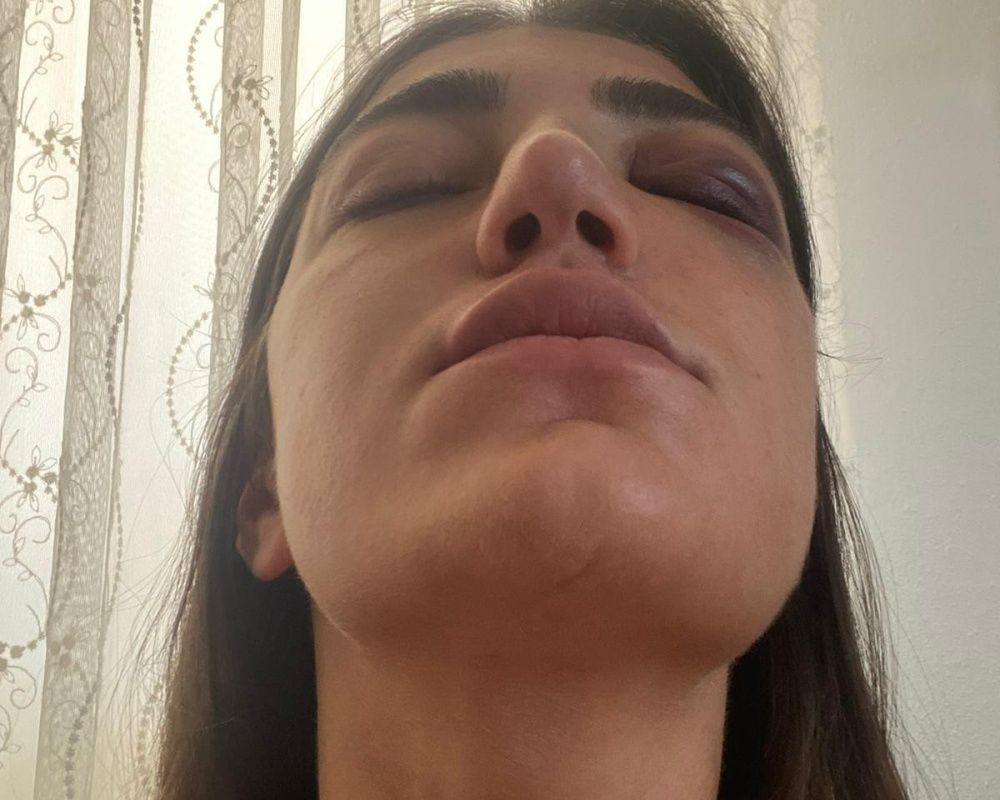 Öldüresiye dövmüştü! Manken Gizem Akbaş saplantılı eski sevgilisinin tahliyesine isyan etti 18