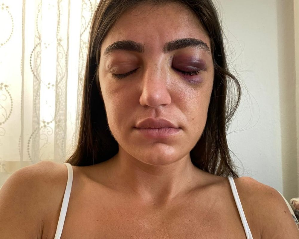 Öldüresiye dövmüştü! Manken Gizem Akbaş saplantılı eski sevgilisinin tahliyesine isyan etti 19