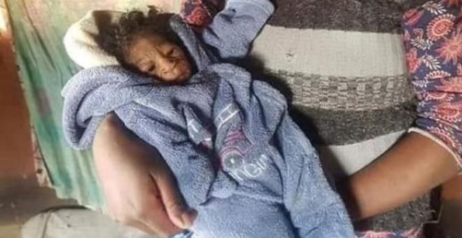 Dünya bu bebeği konuşuyor! Doğum yapan anne, çocuğunu görünce şoke oldu... 5