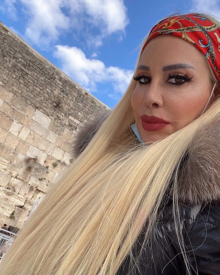 Estetiğin dozunu fazla kaçırdı... İmaj değiştiren şarkıcı Linet'in eski halinden eser kalmadı 5