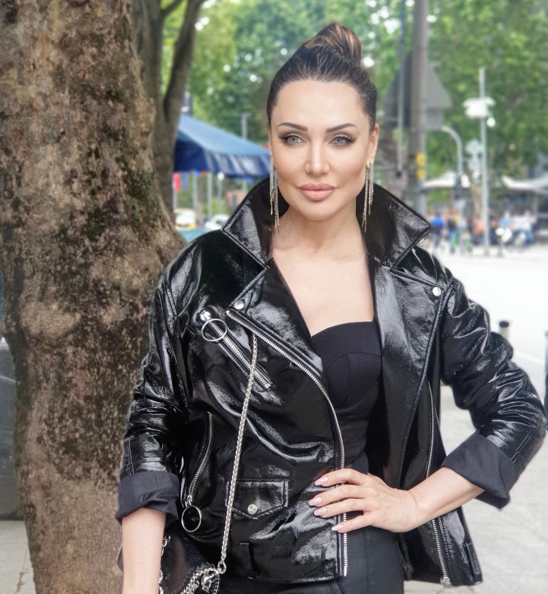 Türkiye'nin Angelina Jolie'si Umut Akyürek estetiği abarttı! Gün geçtikçe gençleşiyor 22