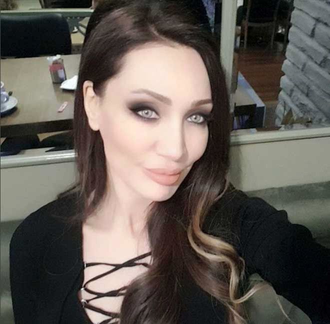 Türkiye'nin Angelina Jolie'si Umut Akyürek estetiği abarttı! Gün geçtikçe gençleşiyor 8