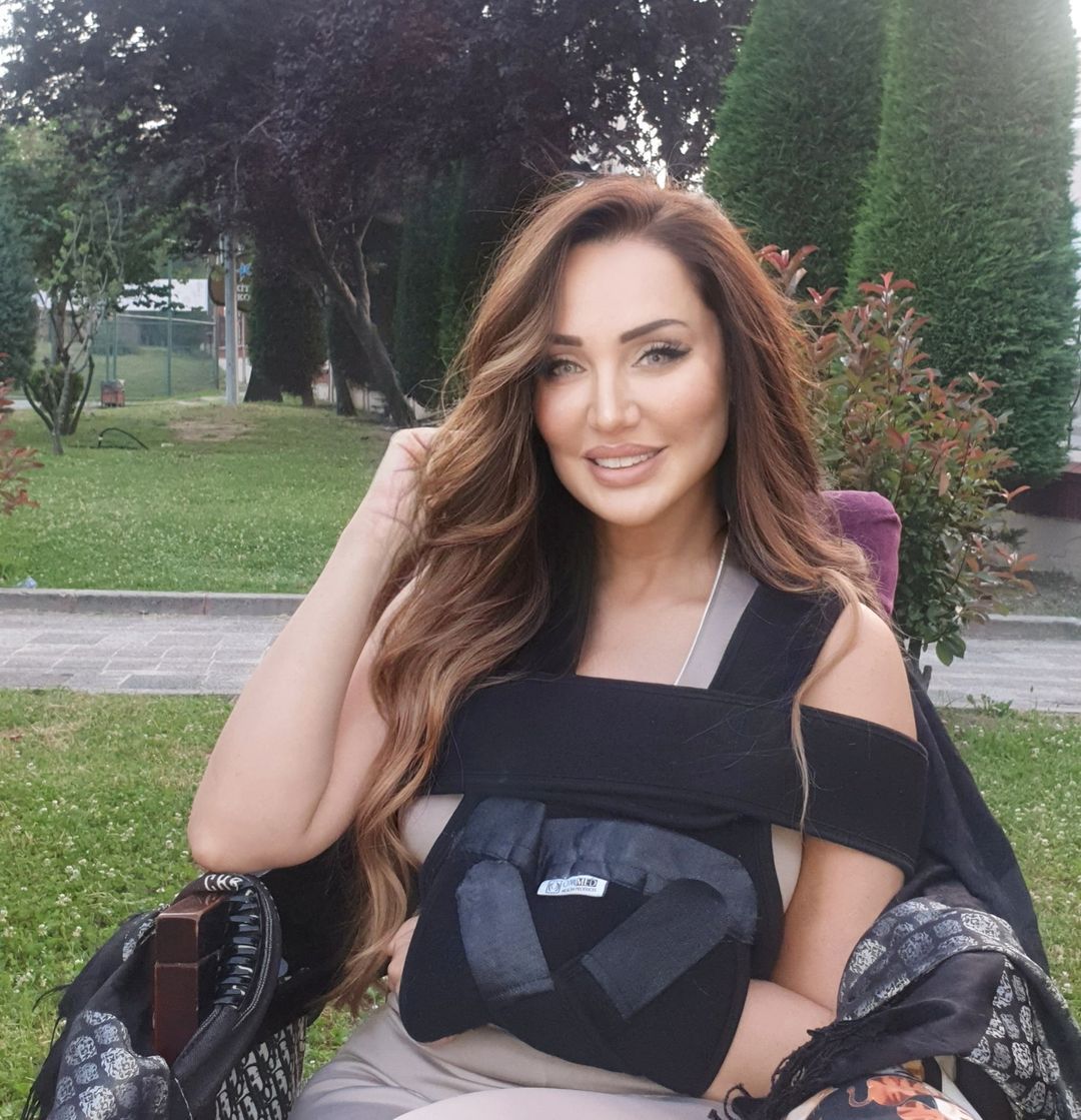 Türkiye'nin Angelina Jolie'si Umut Akyürek estetiği abarttı! Gün geçtikçe gençleşiyor 24