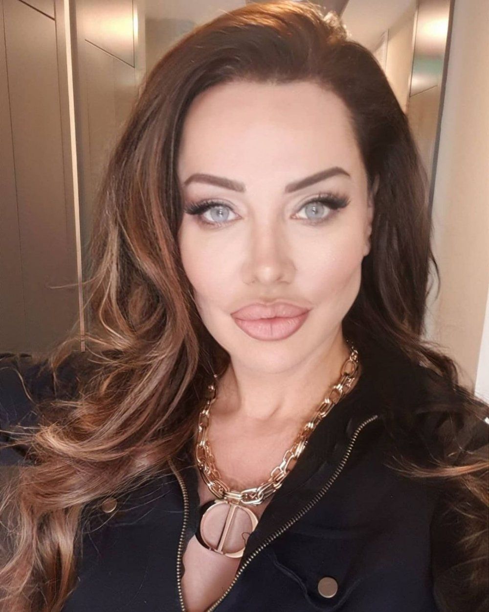 Türkiye'nin Angelina Jolie'si Umut Akyürek estetiği abarttı! Gün geçtikçe gençleşiyor 15