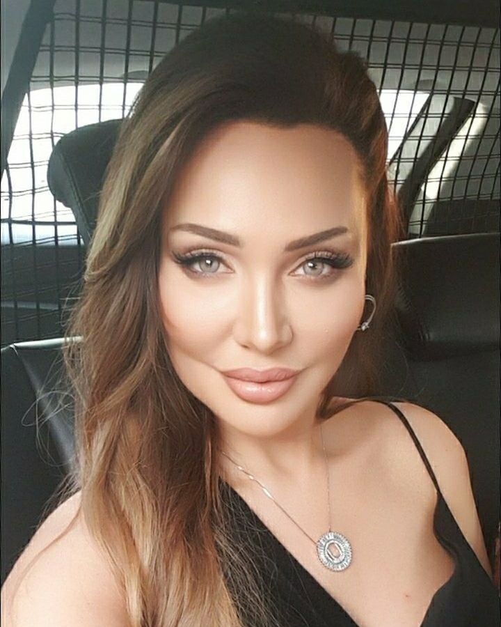 Türkiye'nin Angelina Jolie'si Umut Akyürek estetiği abarttı! Gün geçtikçe gençleşiyor 27