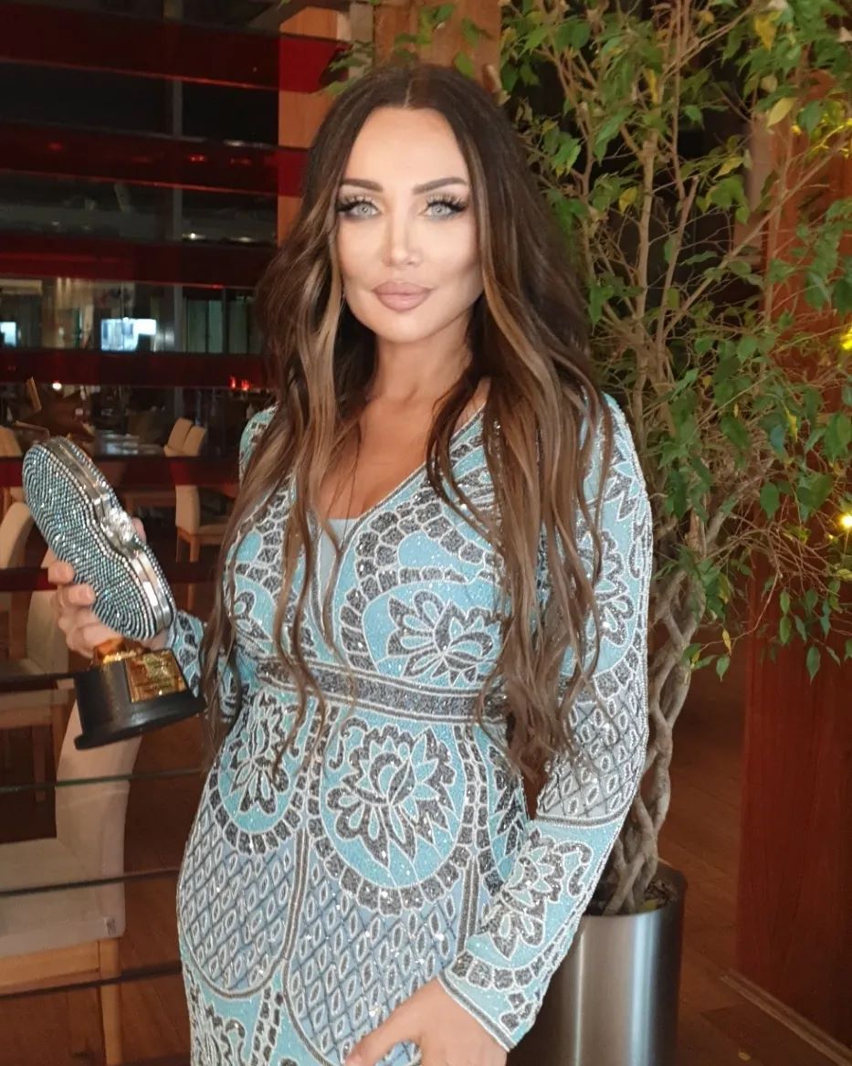 Türkiye'nin Angelina Jolie'si Umut Akyürek estetiği abarttı! Gün geçtikçe gençleşiyor 35